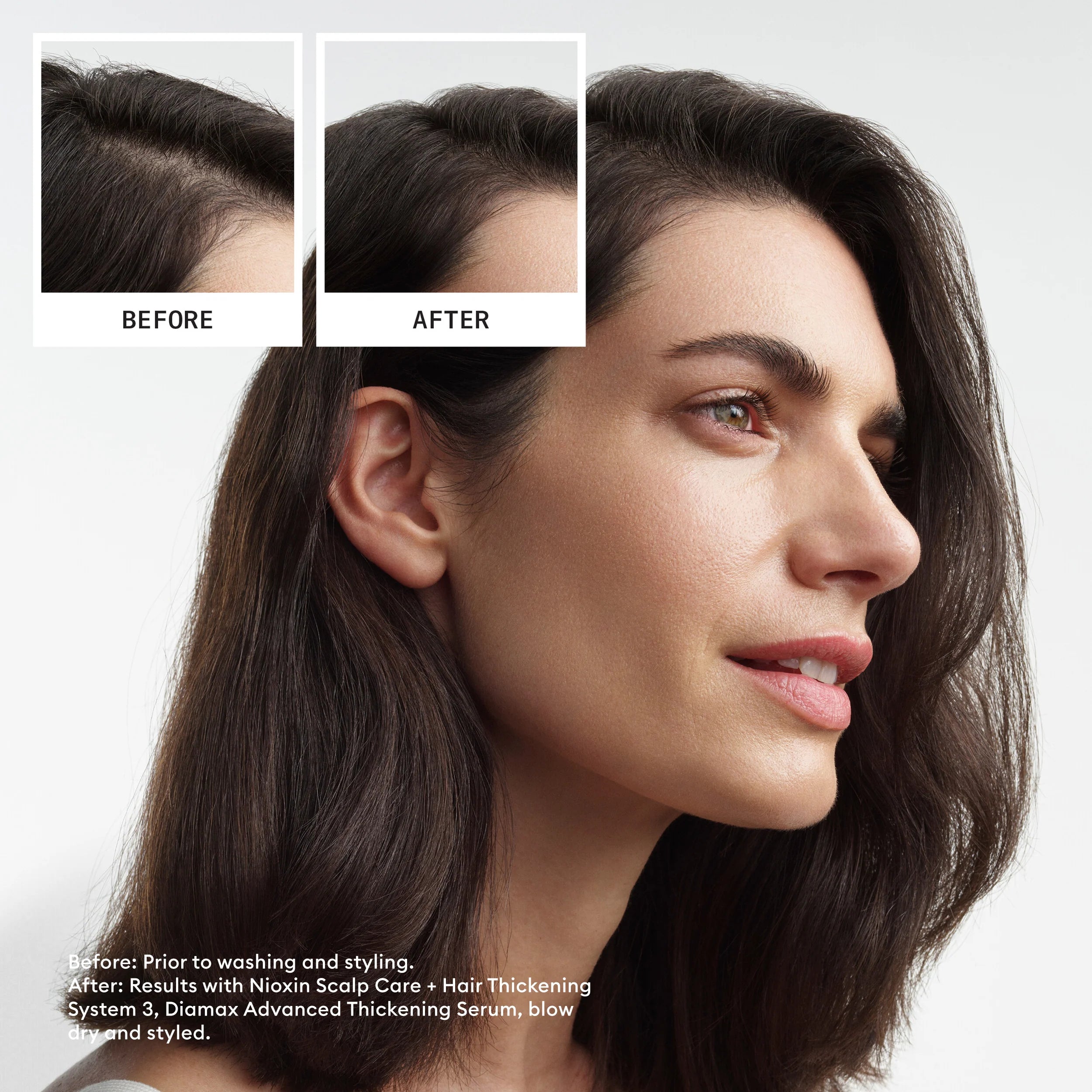 Nioxin Scalp + Hair Thickening System 3 - Includes Shampoo, Conditioner and Scalp Treatment