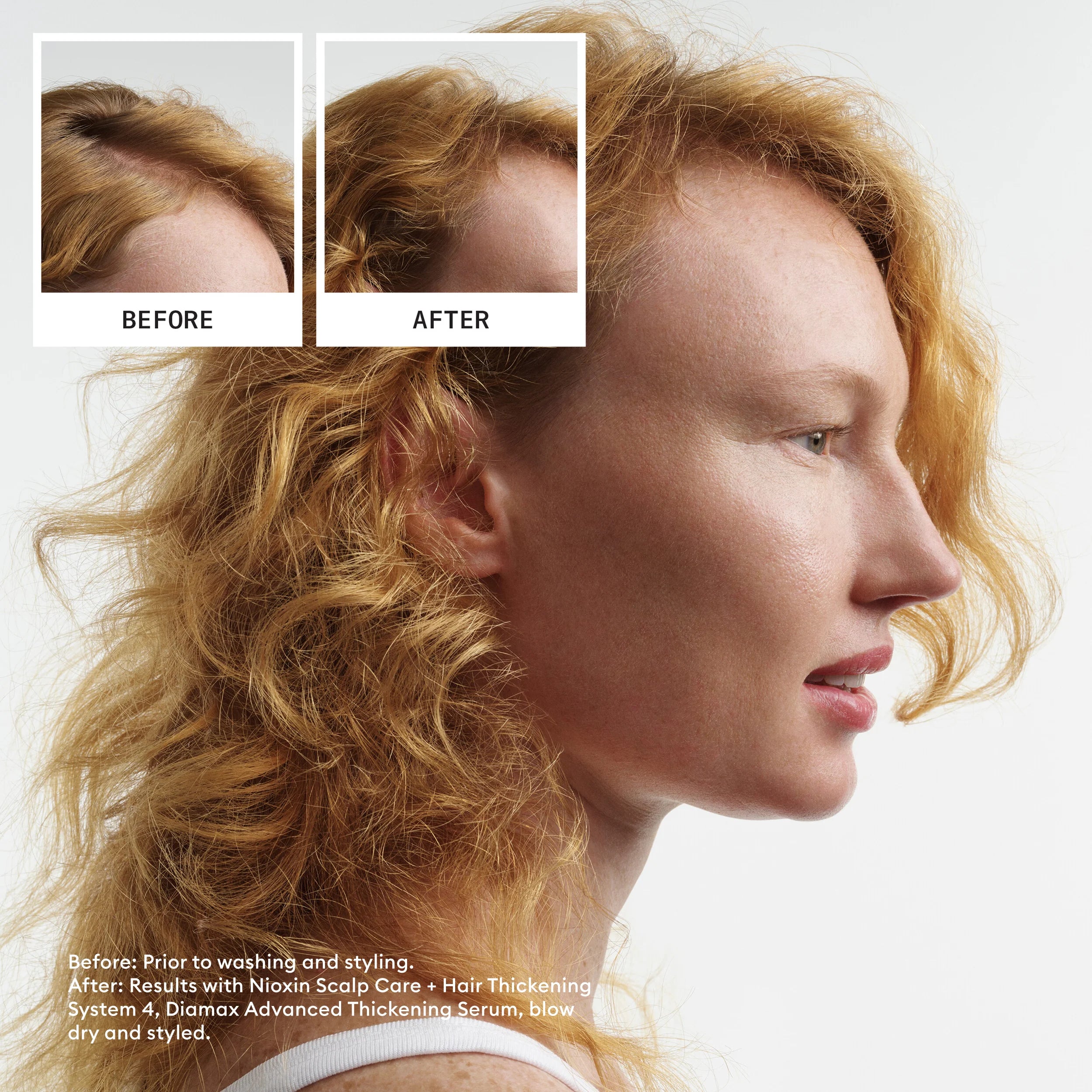 Nioxin Scalp + Hair Thickening System 4 - Includes Shampoo, Conditioner and Scalp Treatment