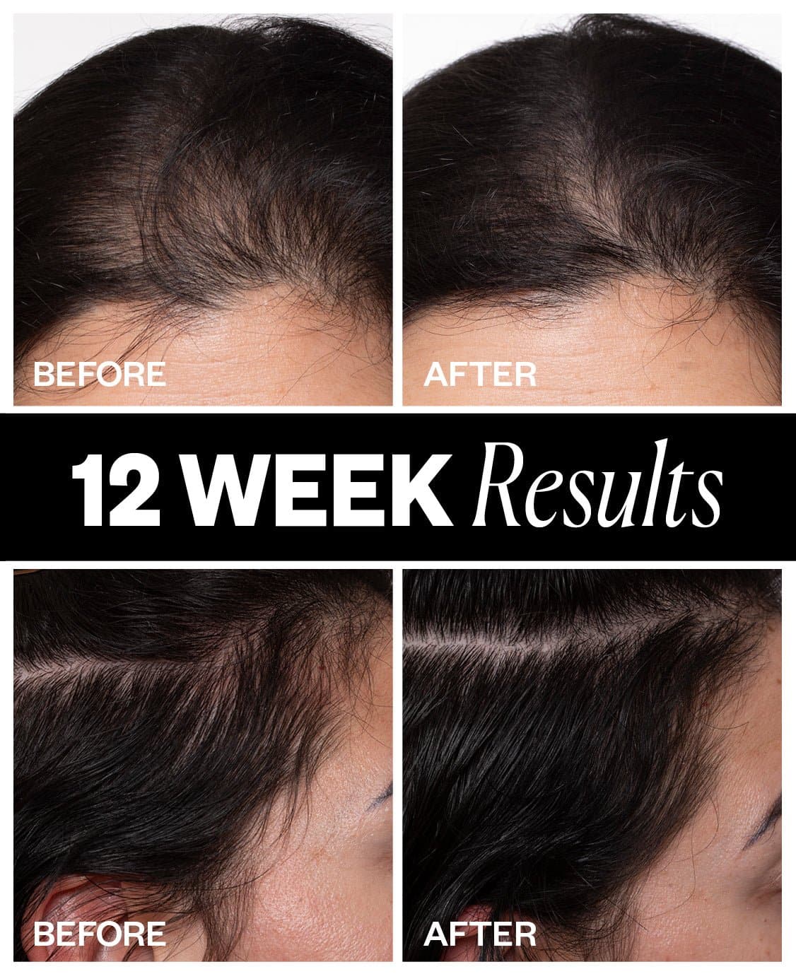 IGK Sponsored Hair Density Scalp Treatment