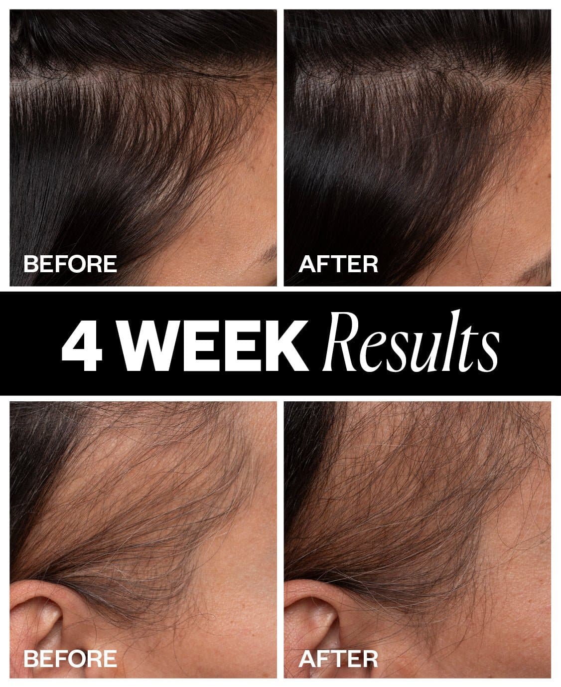 IGK Sponsored Hair Density Scalp Treatment