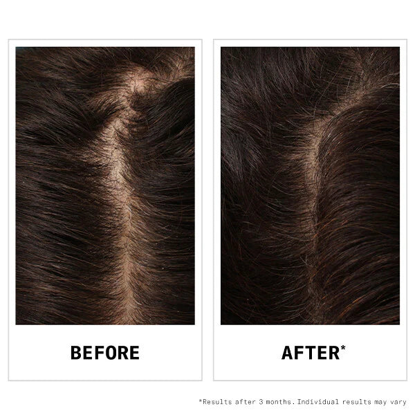 Nioxin Ultimate Power Hair Fall Defense Shampoo